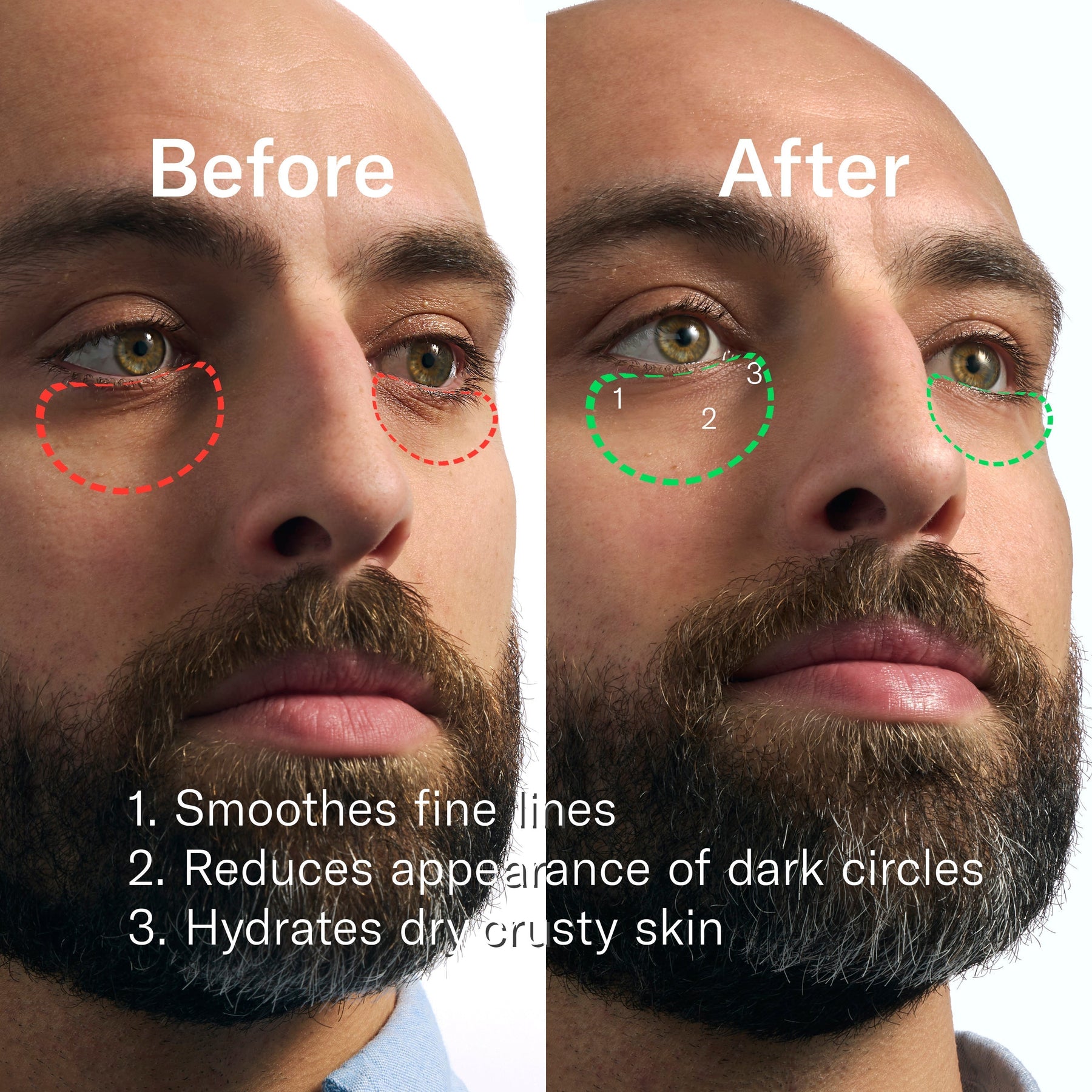 Rapid Restore Eye Patches - 6 pack
